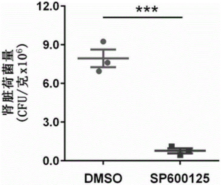 Application of JNK inhibitor in preparing drug