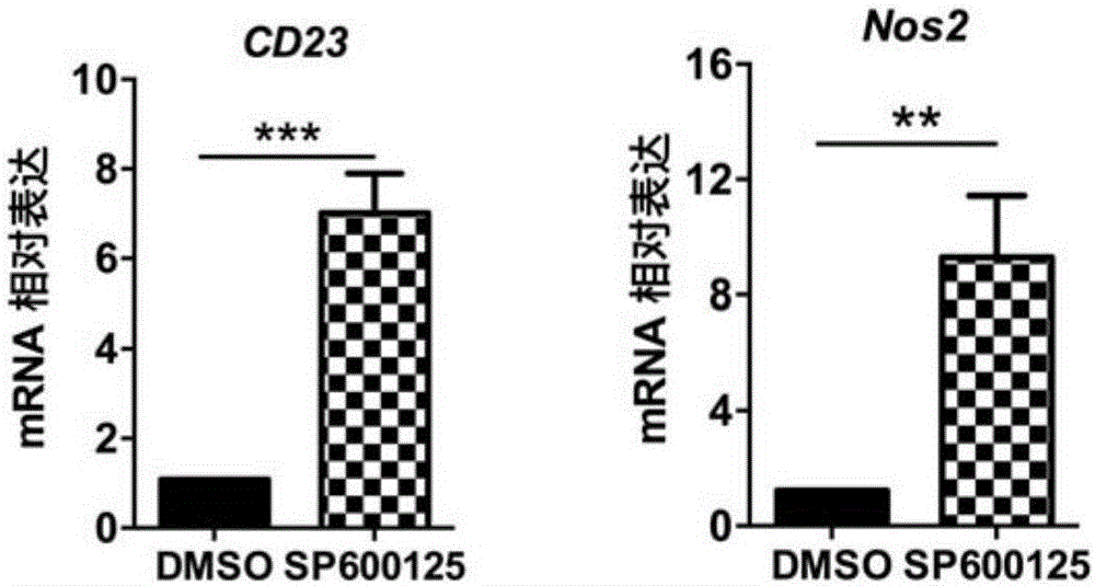 Application of JNK inhibitor in preparing drug