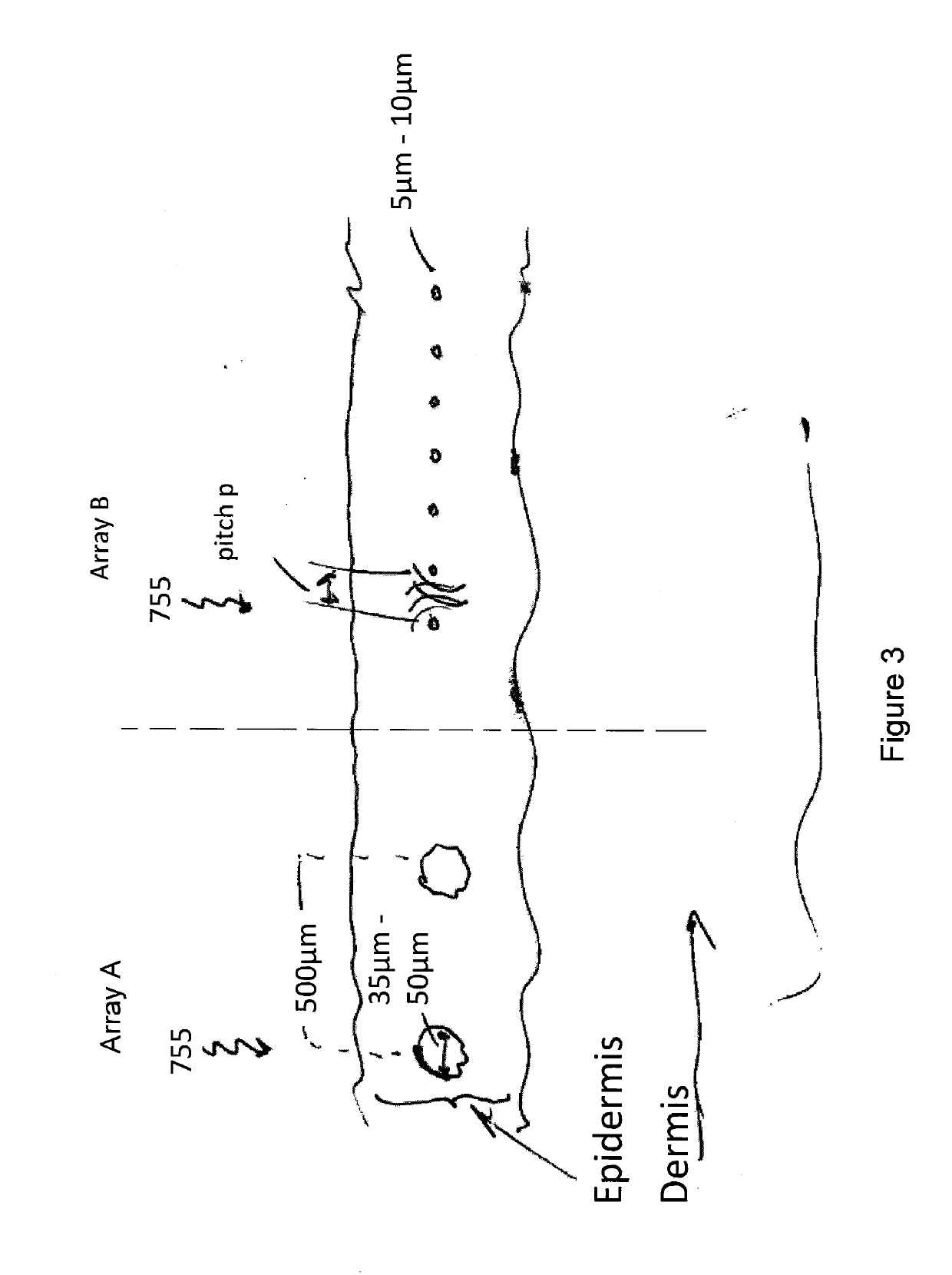 Controlled photomechanical and photothermal tissue treatment in the picosecond regime