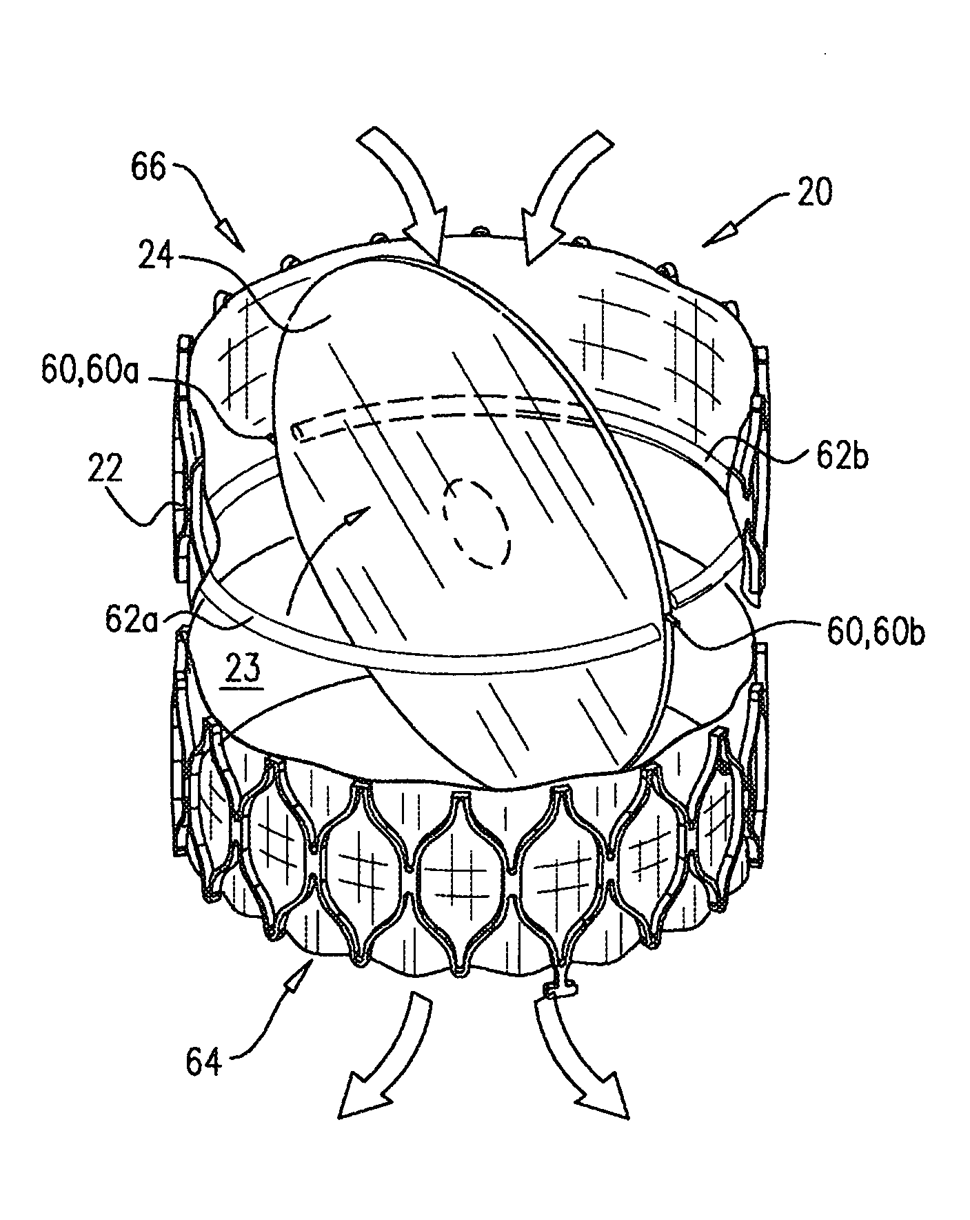 Percutaneously-deliverable mechanical valve