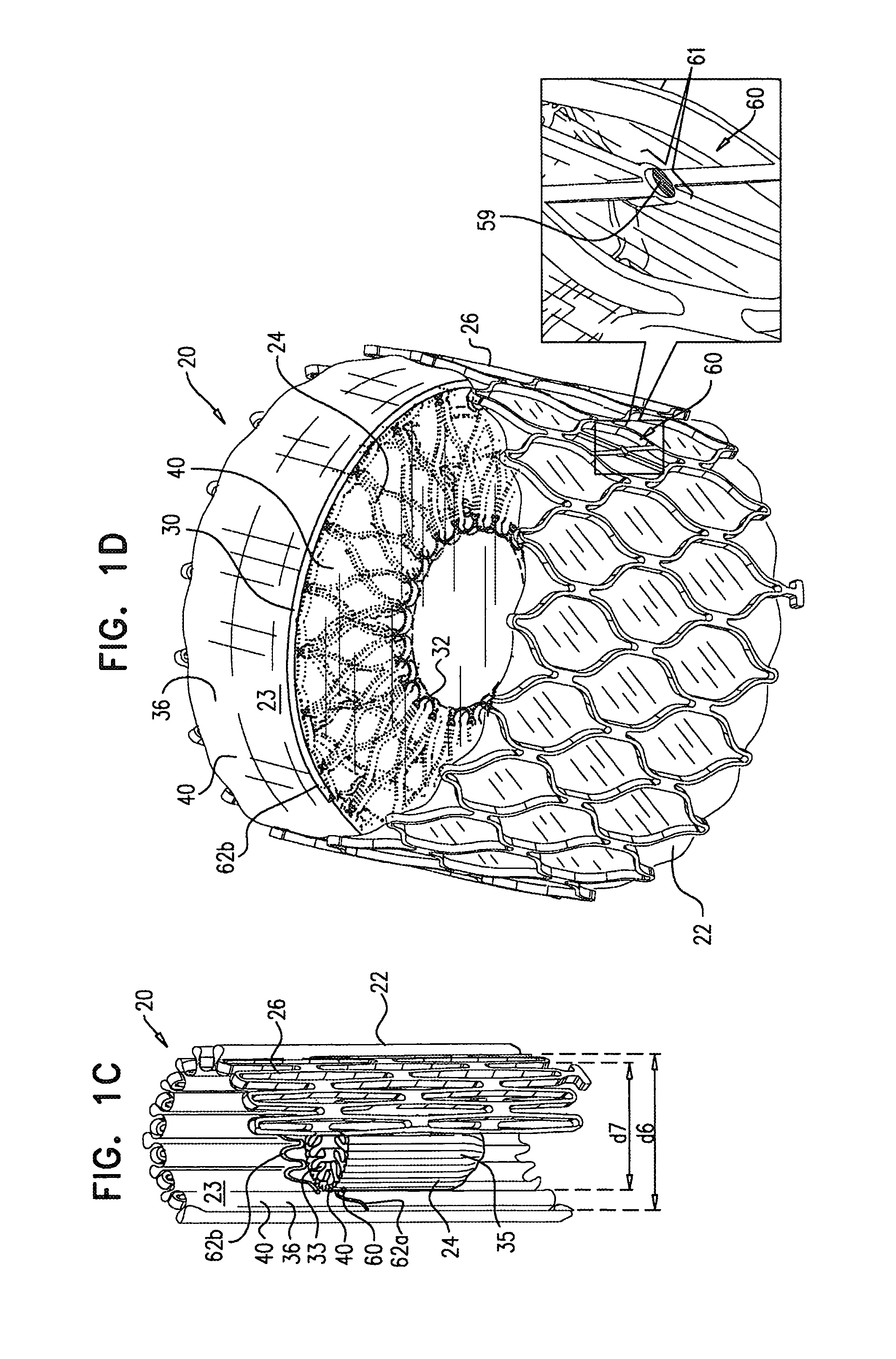 Percutaneously-deliverable mechanical valve