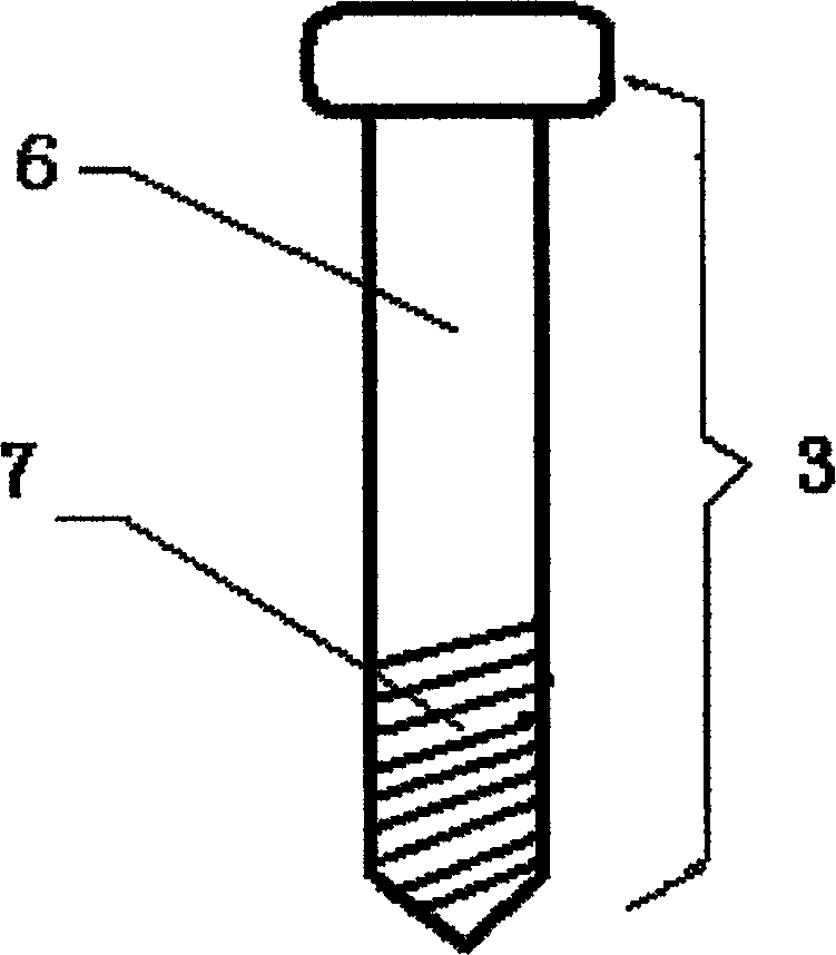 Angled locking steel plate