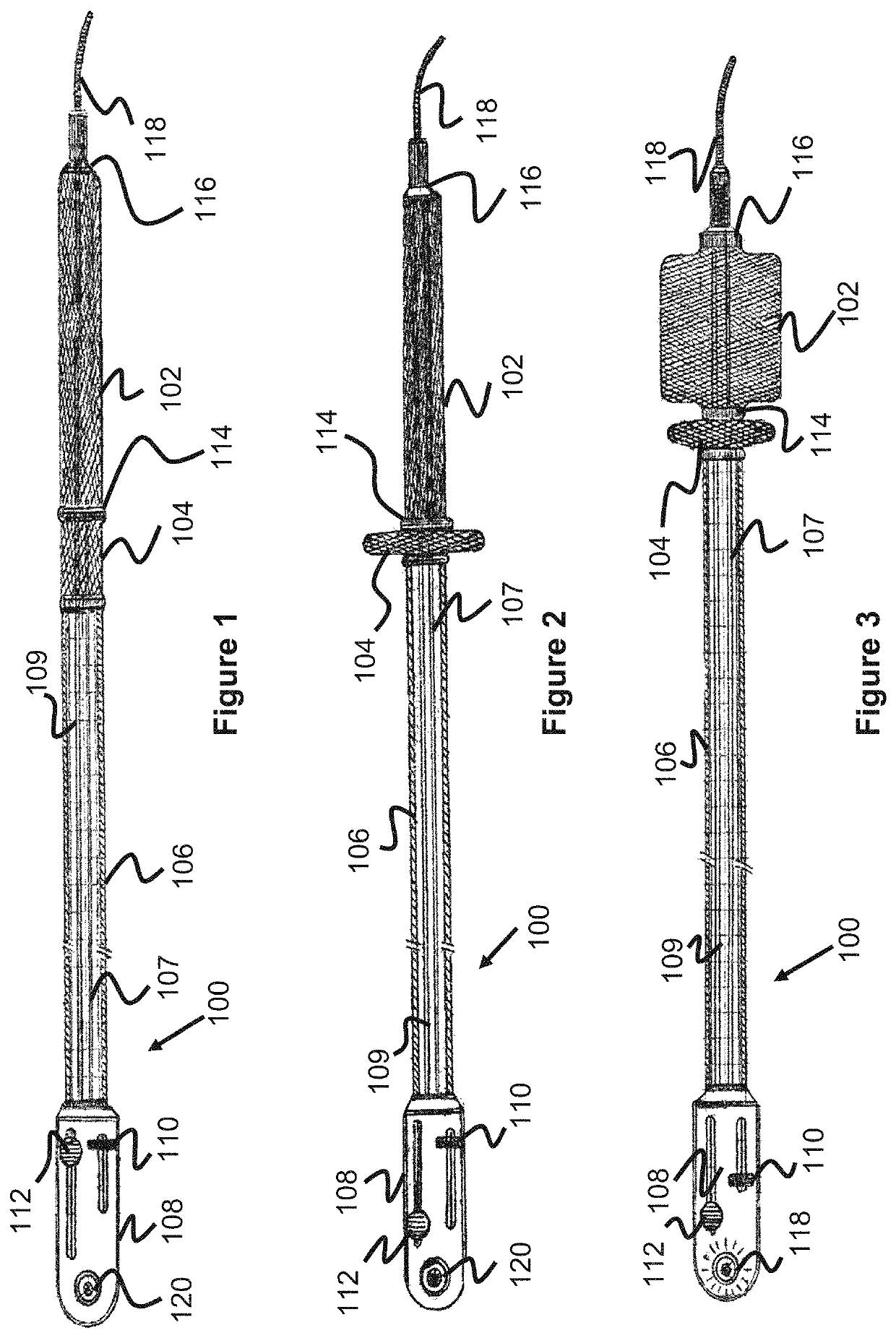 Temporary aortic occlusion device