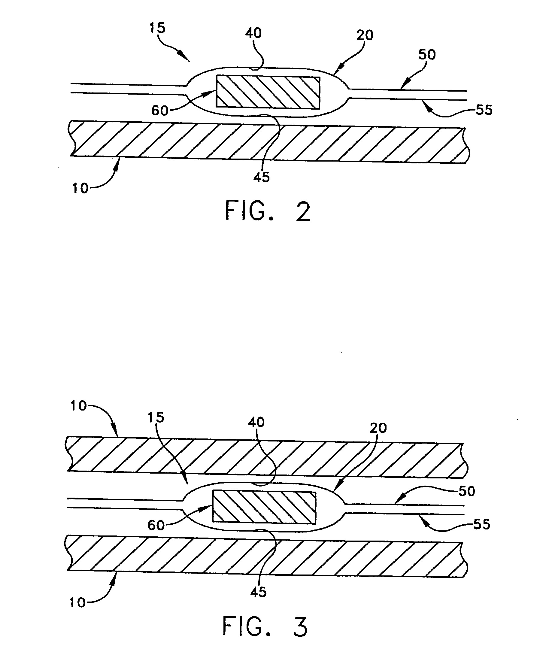 Personal cooling or warming system using closed loop fluid flow