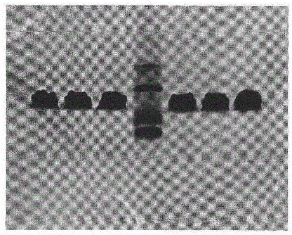 Method for detecting thymosin beta 4 content based on high performance liquid chromatograph