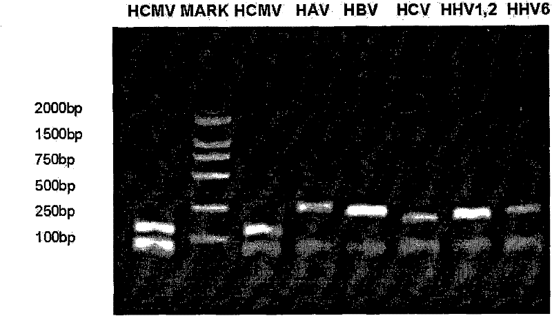 Multiple PCR detection kit for virus hepatitis pathogens and preparation and application thereof