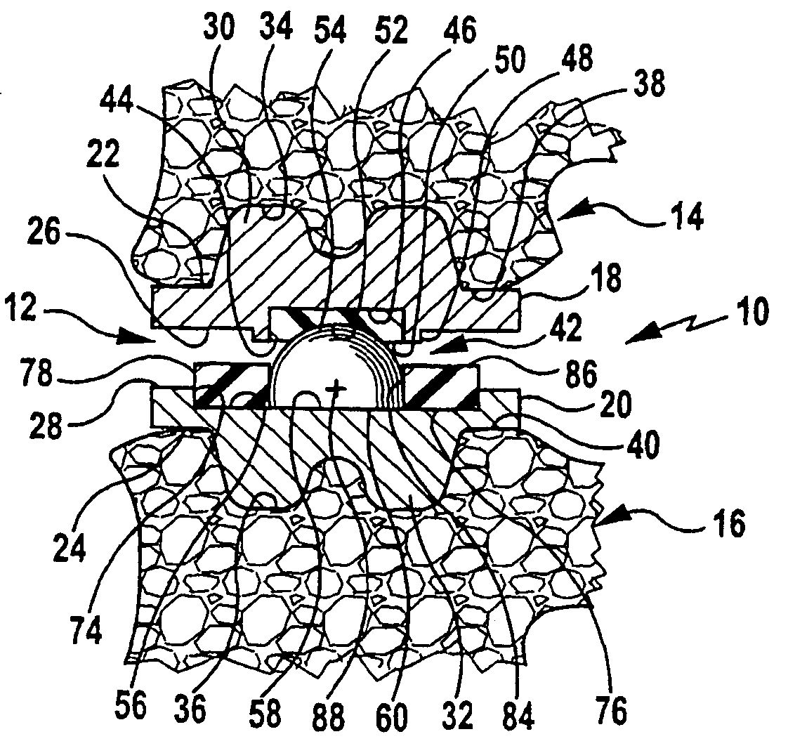 Intervertebral implant