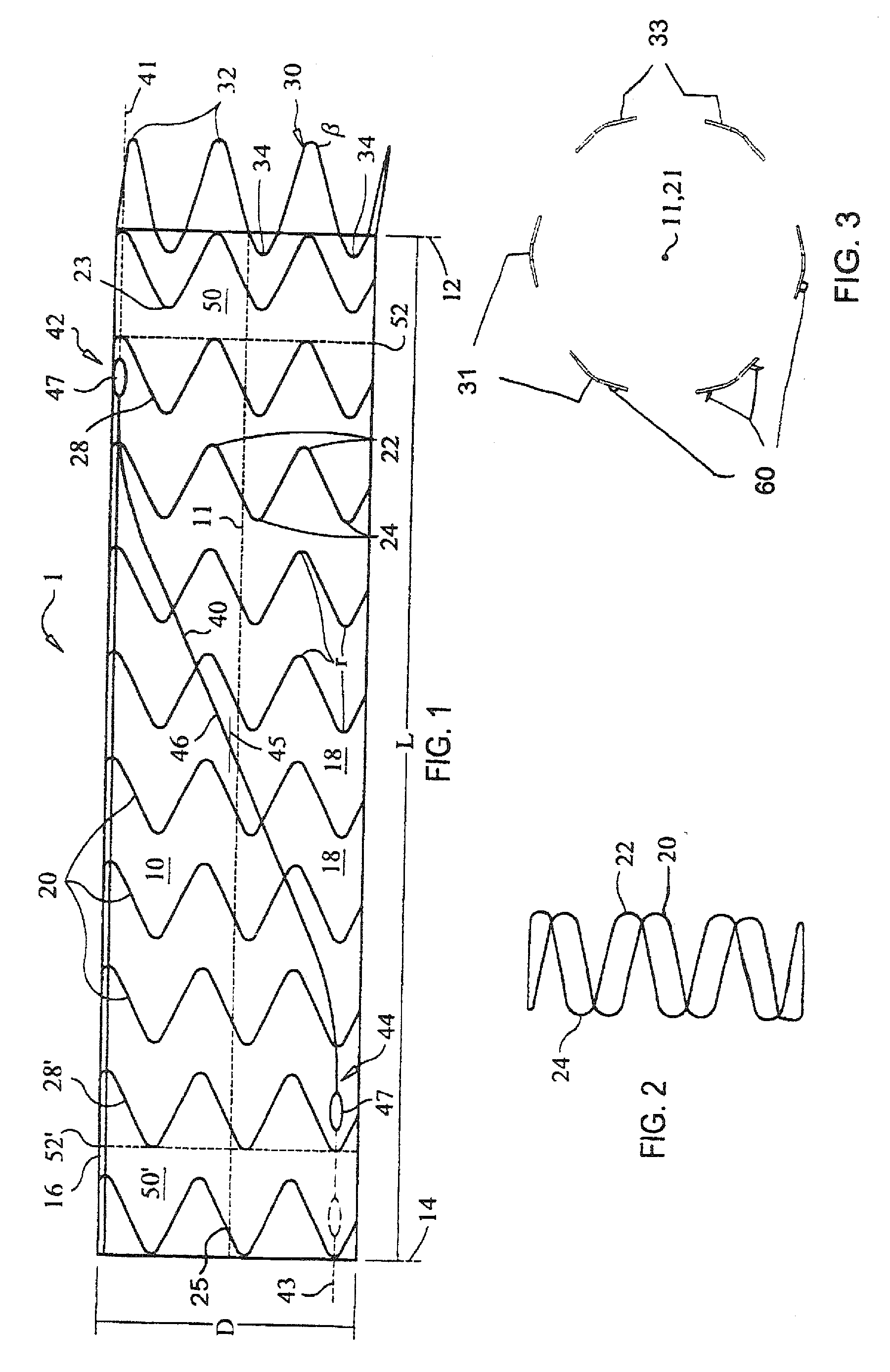 Stent Graft Delivery System Handle