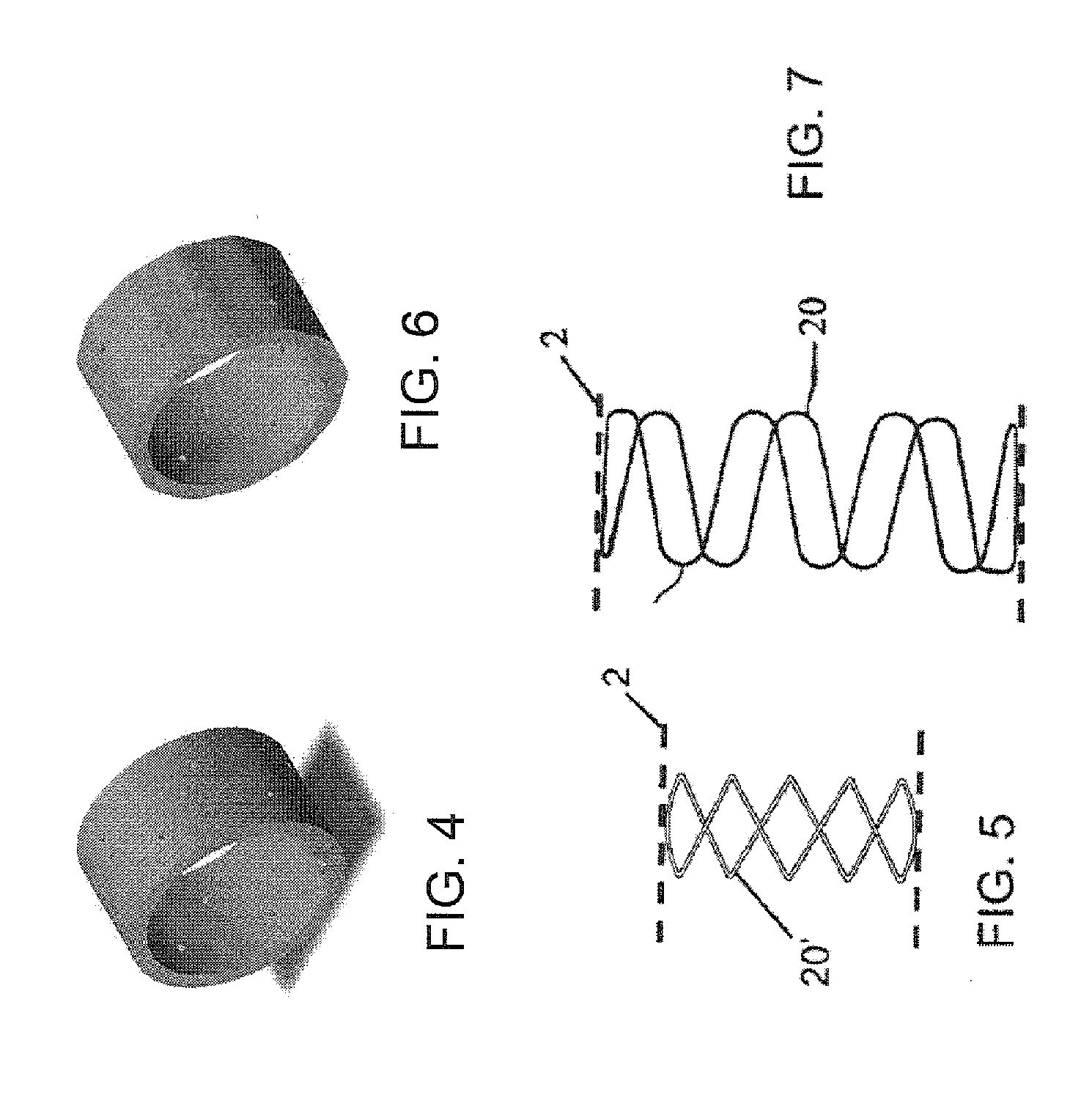 Stent Graft Delivery System Handle