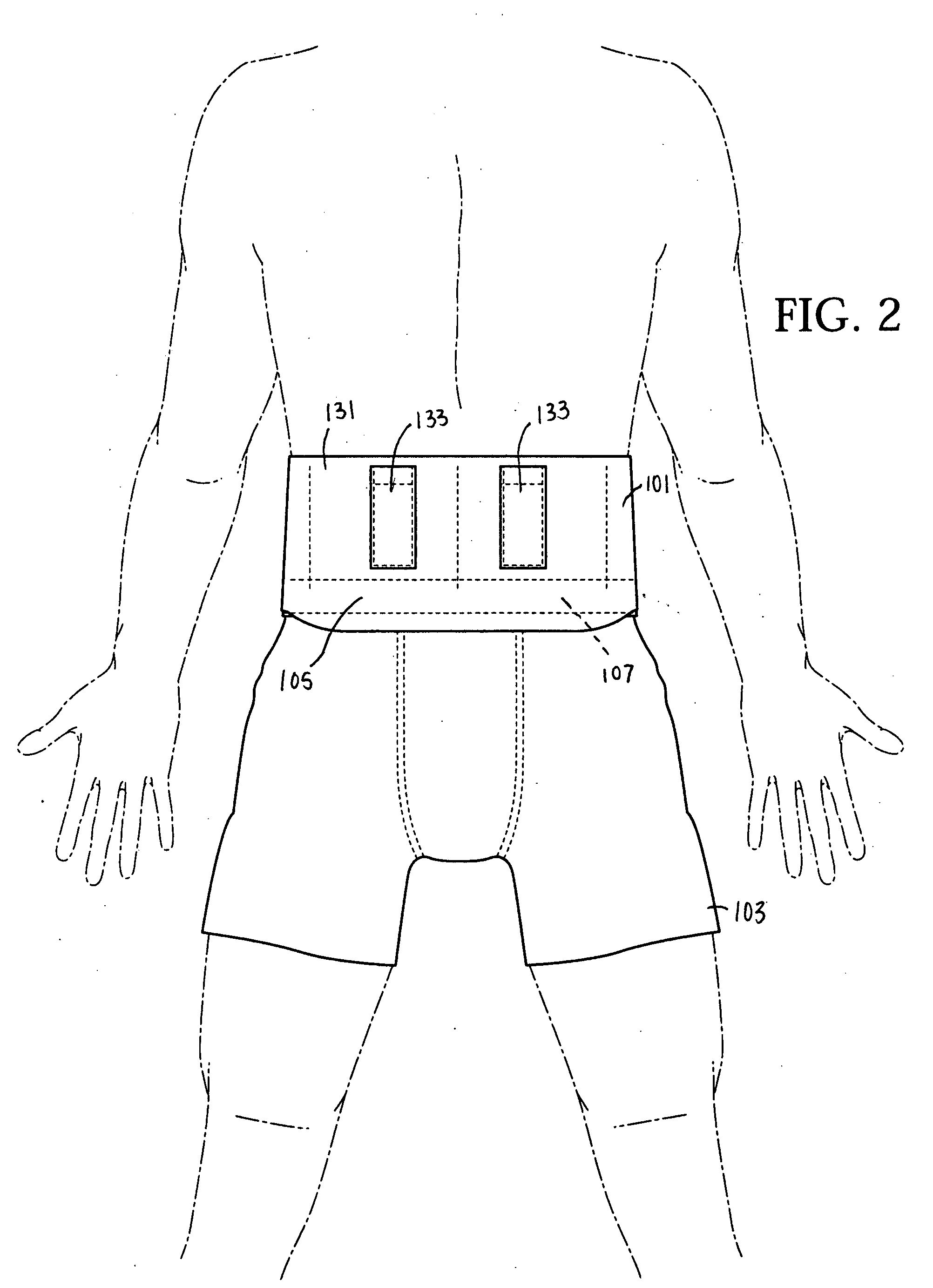 Back support garment apparatus