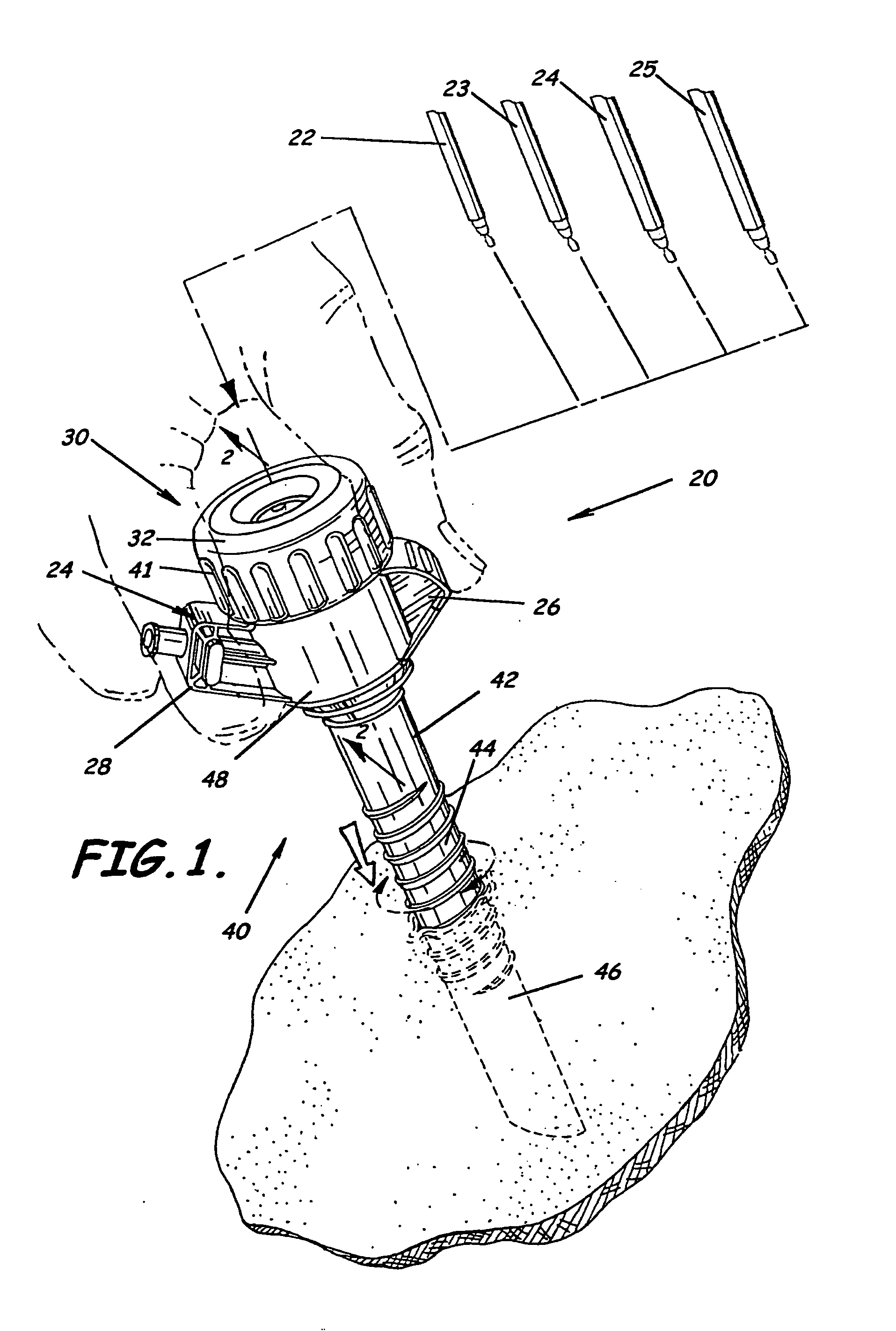 Trocar having planar fixed septum seal and related methods