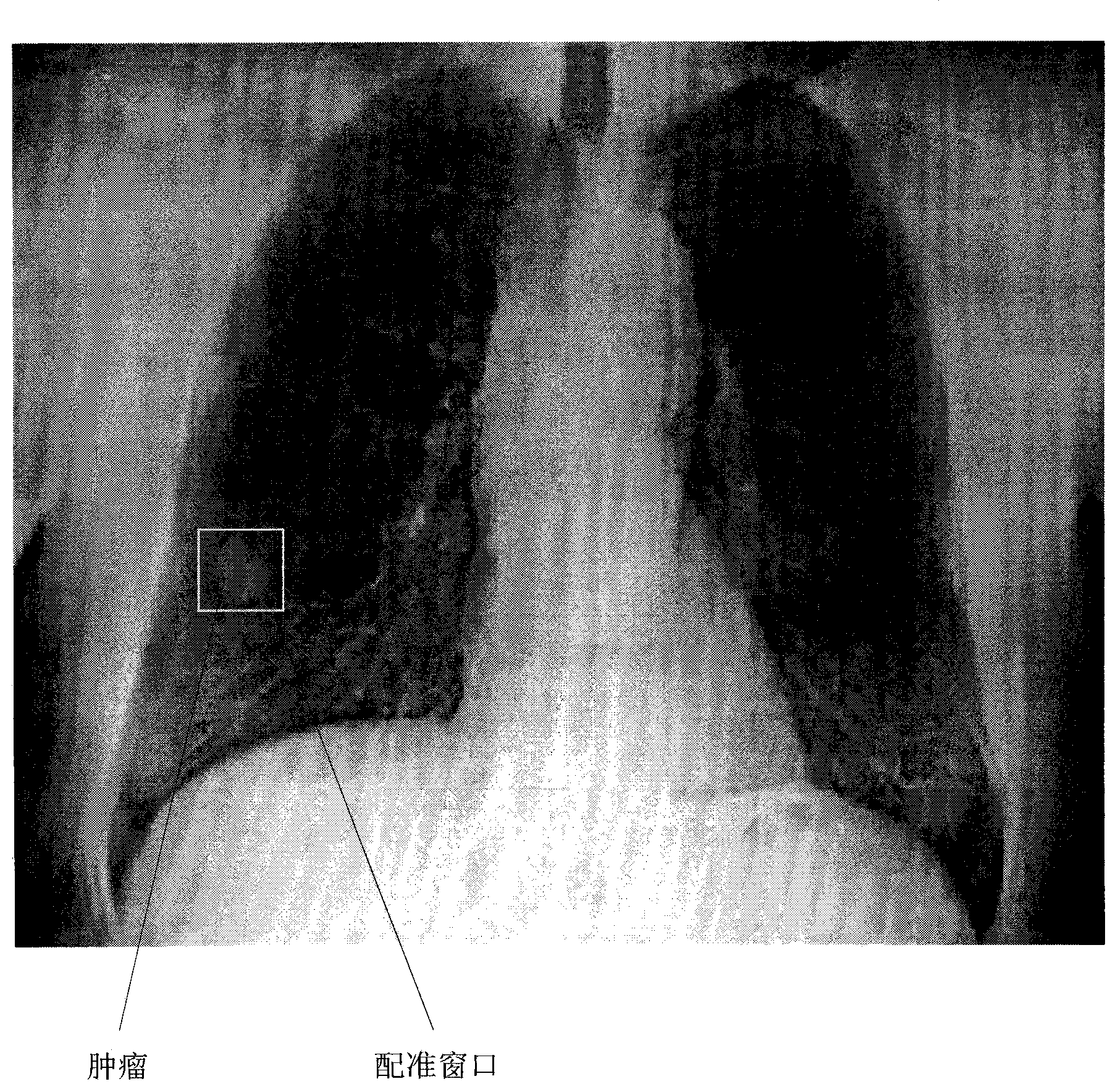 Method and system for positioning soft tissue lesion based on dual-energy X-ray images