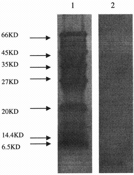 Antibacterial lipopeptide of endophytic Bacillus subtilis and separation and purification method