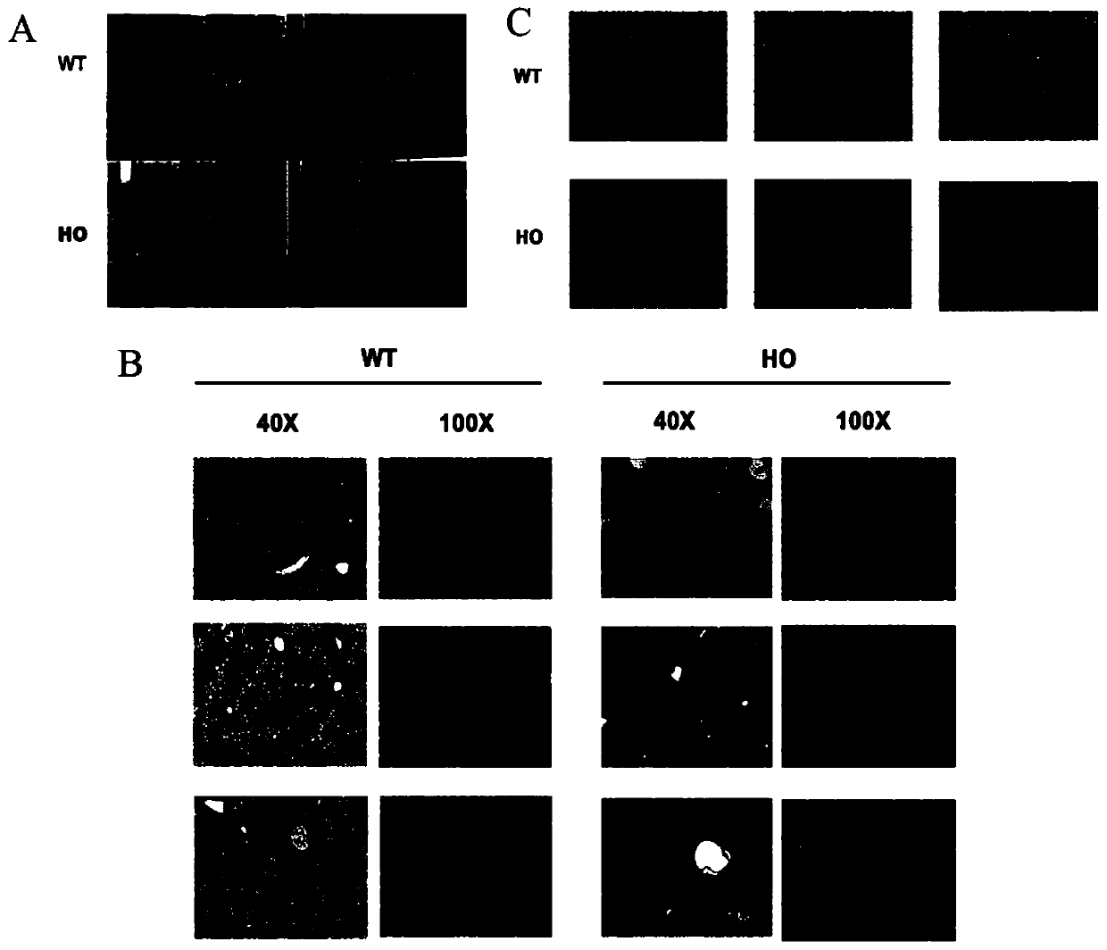 Application of ASB3 in preparation of drugs for treatment of non-alcoholic fatty liver disease