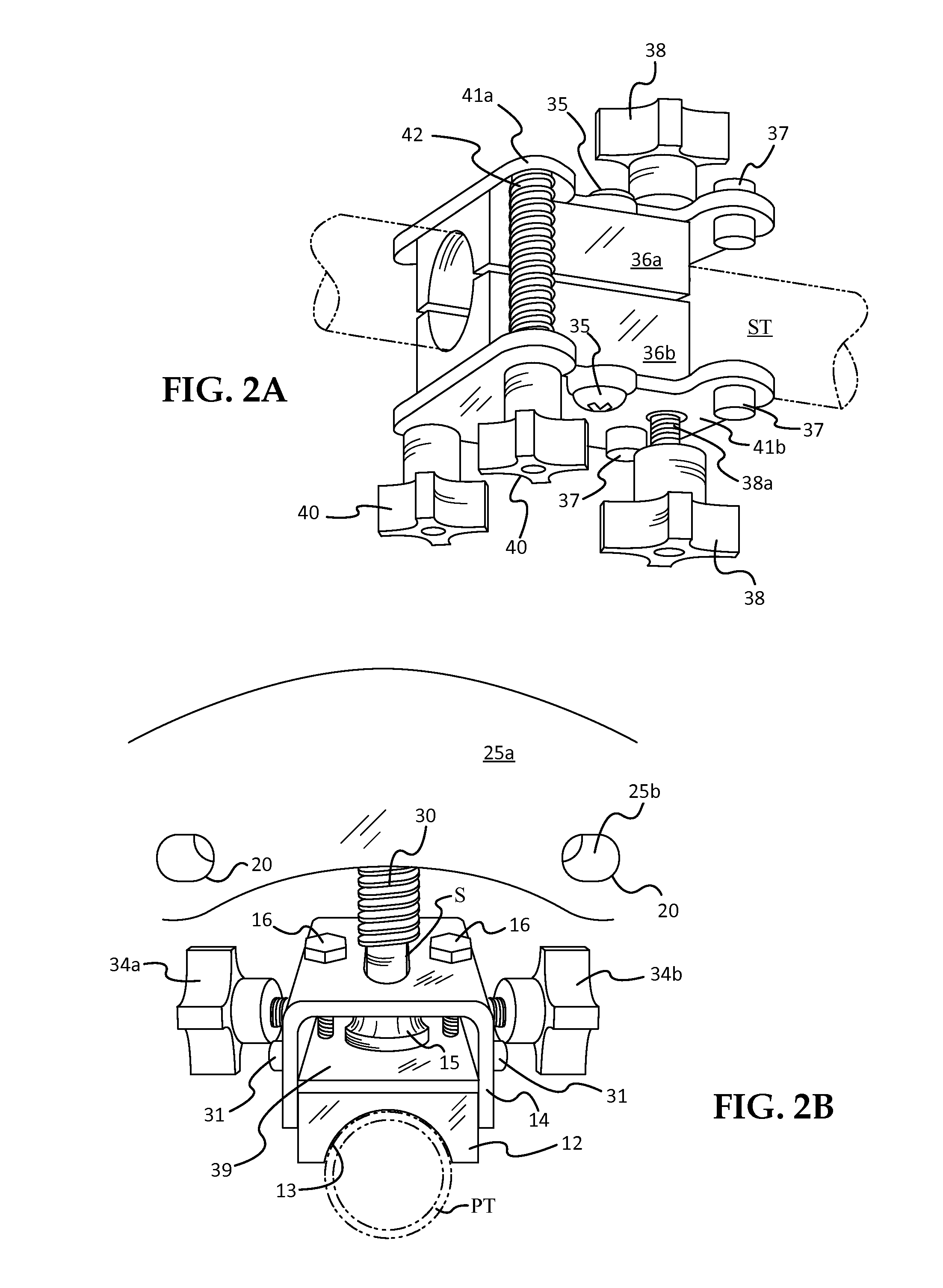 Weld Stress Compensation System