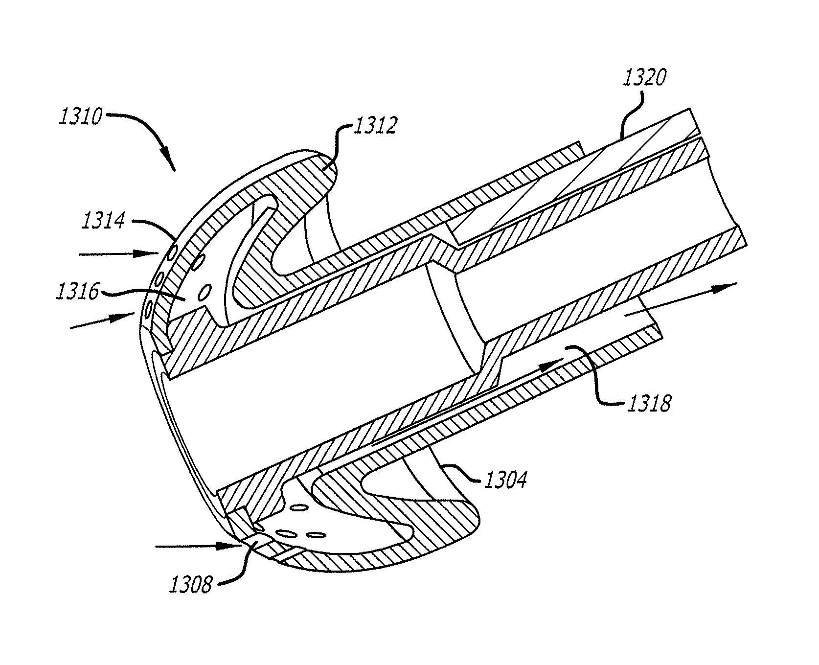 Systems and methods for anesthetizing ear tissue