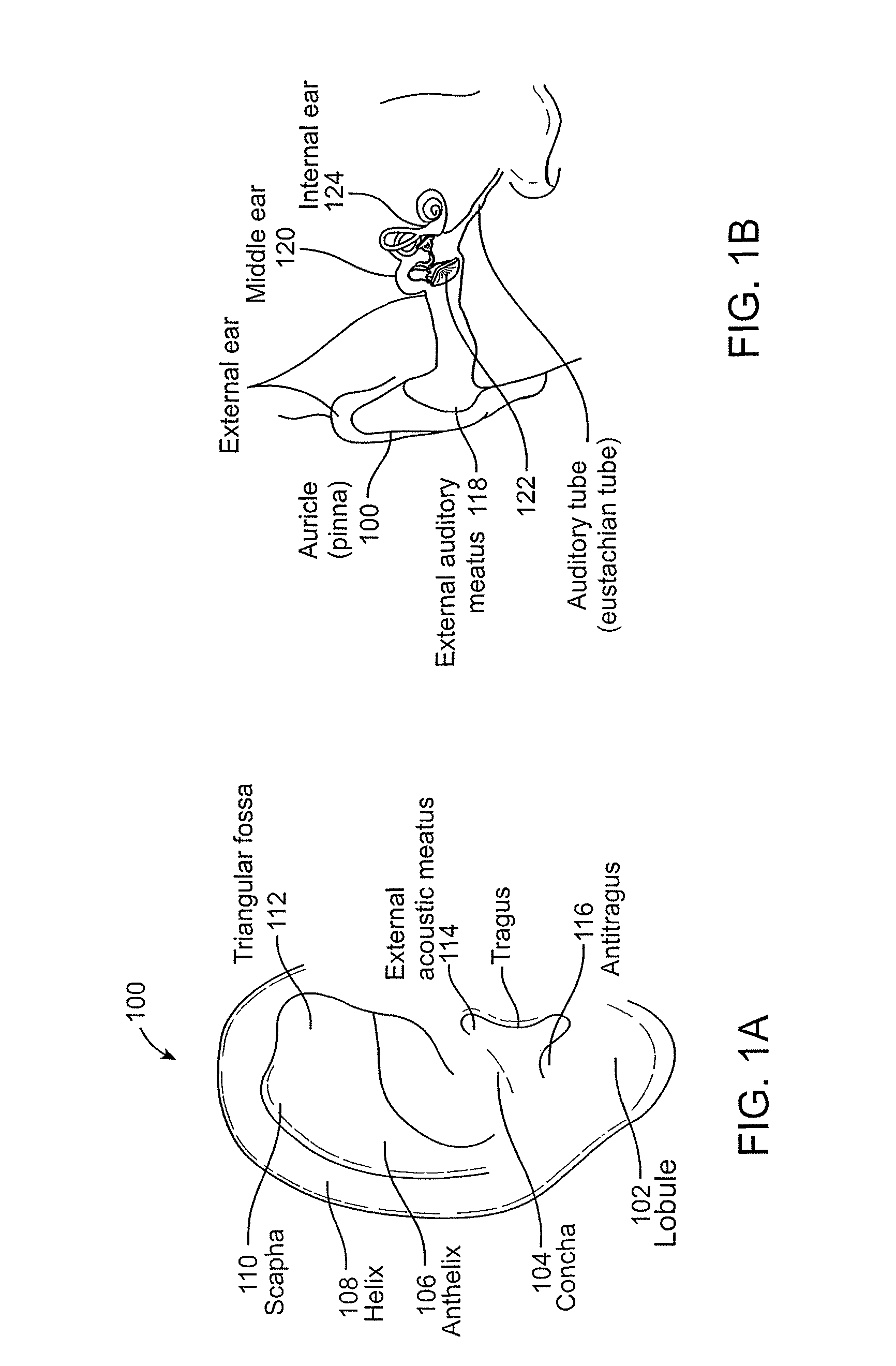 Systems and methods for anesthetizing ear tissue