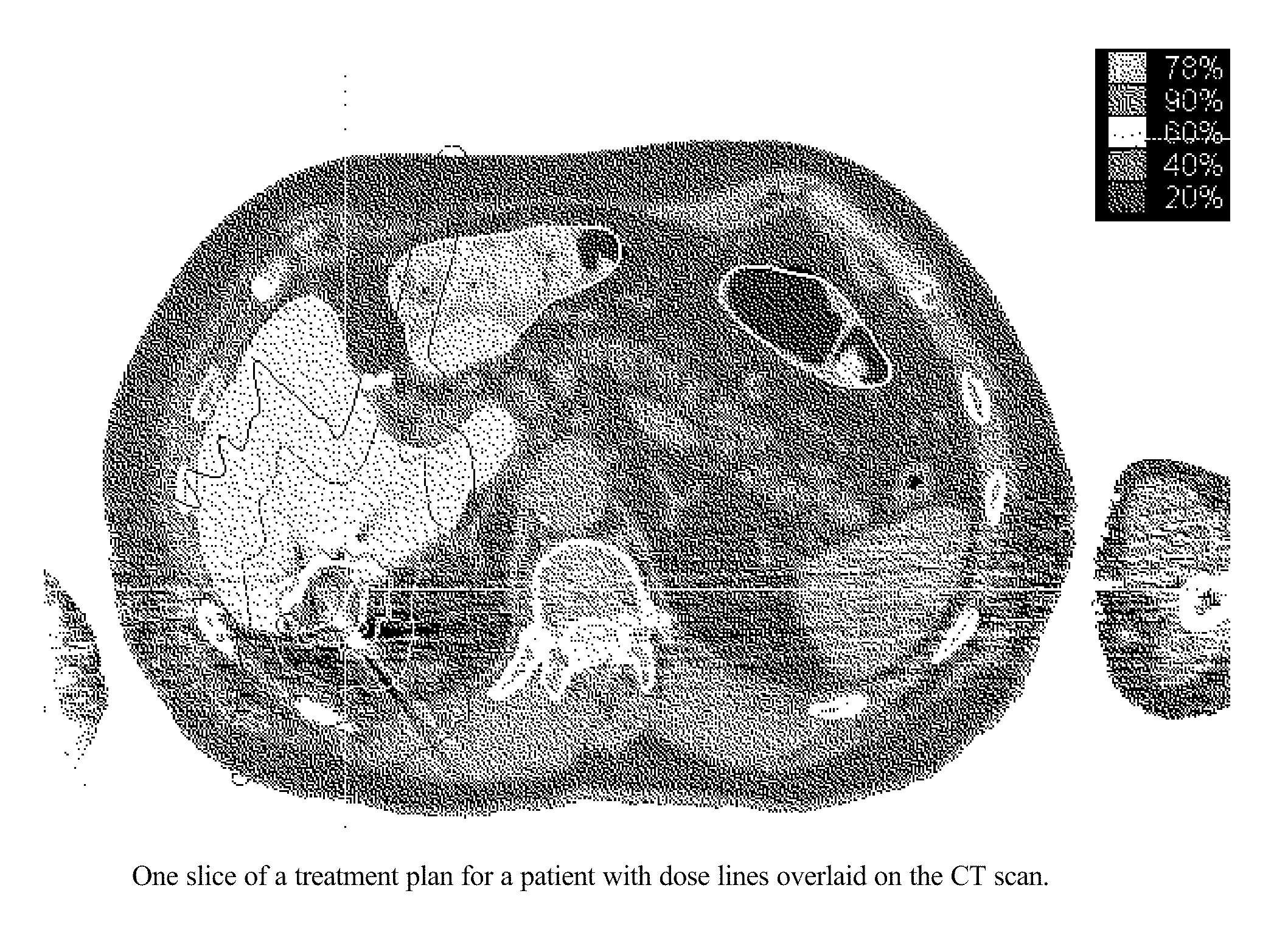 Evaluation of Radiation Dose Tolerance Limits