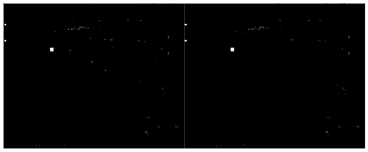 Thyroid nodule focus region generation data enhancement method based on a deep convolutional generative adversarial network