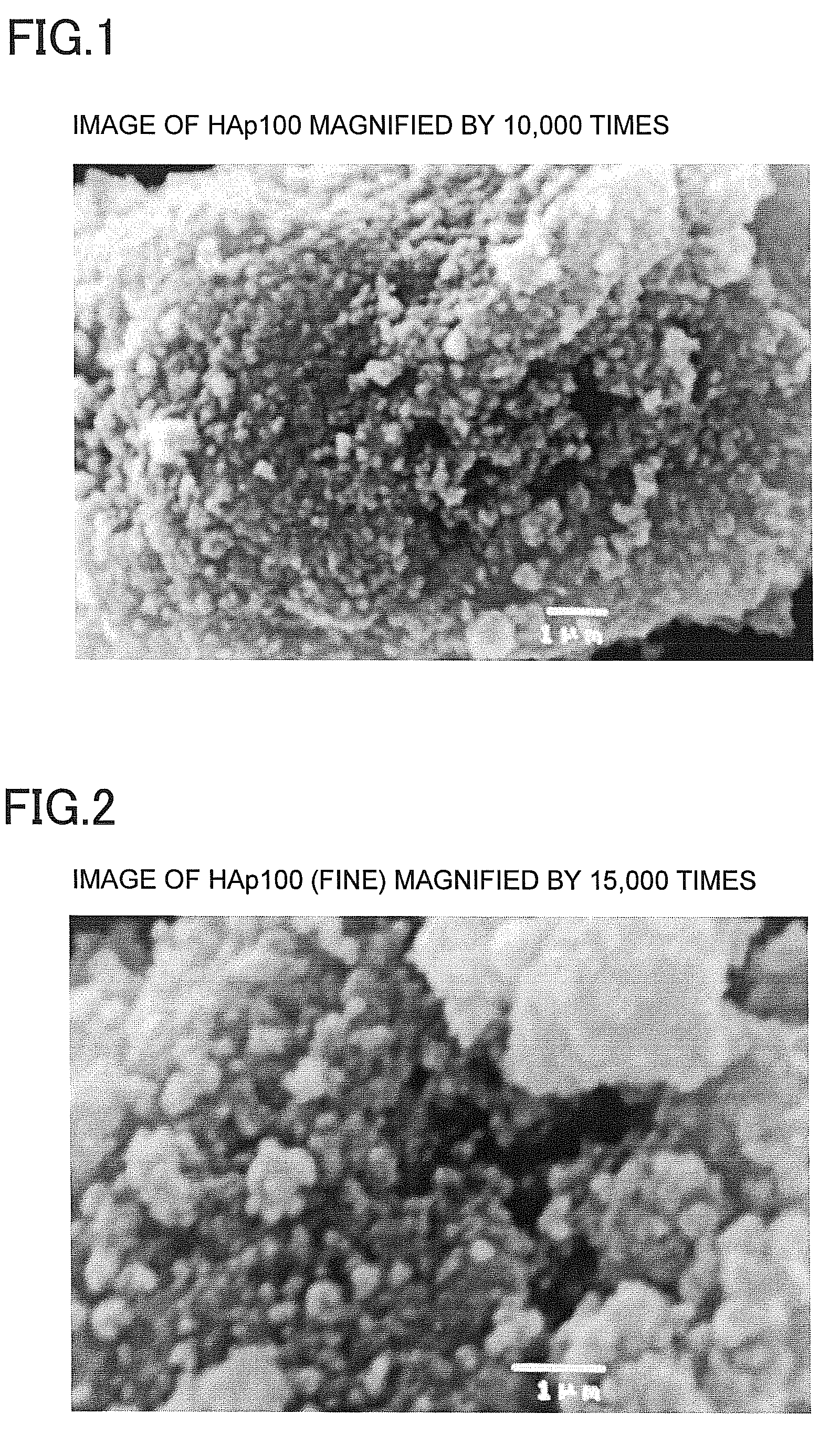 Chemically-curing type glass ionomer cement