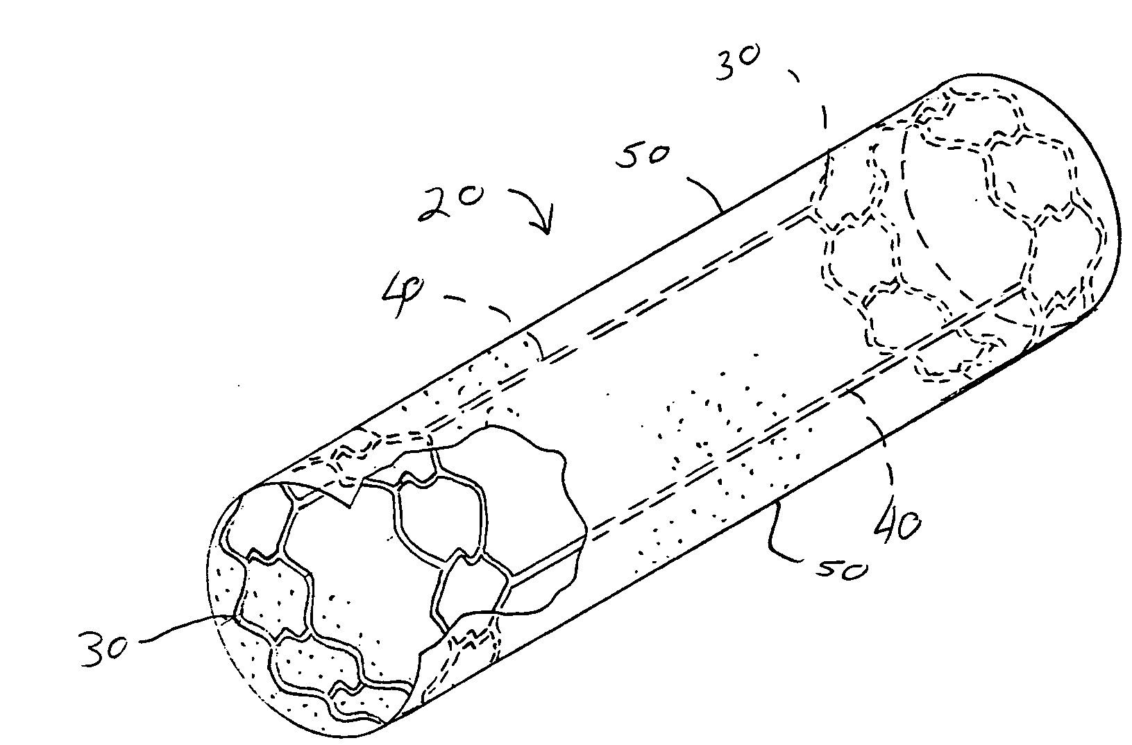 Vascular protective device