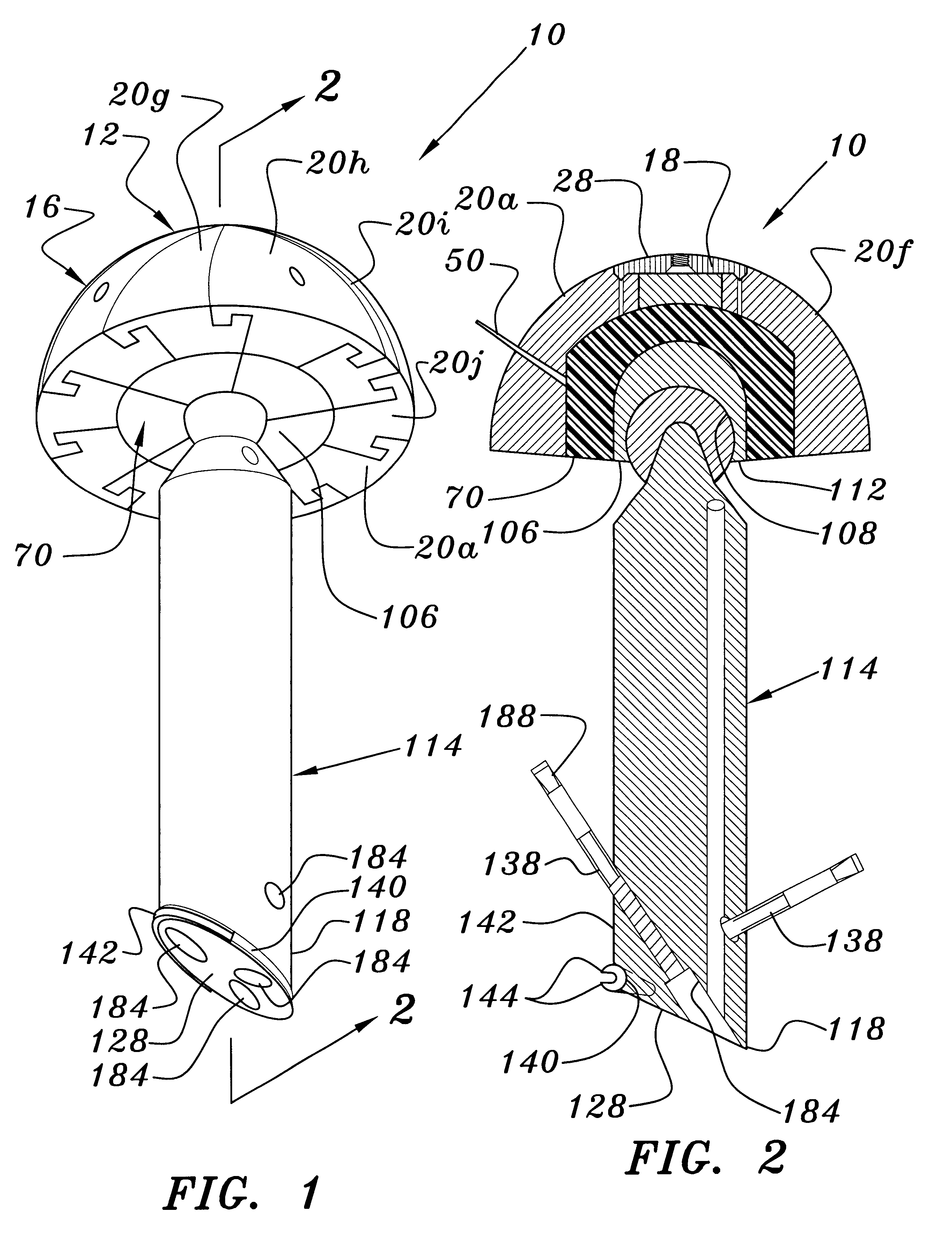 Joint prosthesis and method for placement