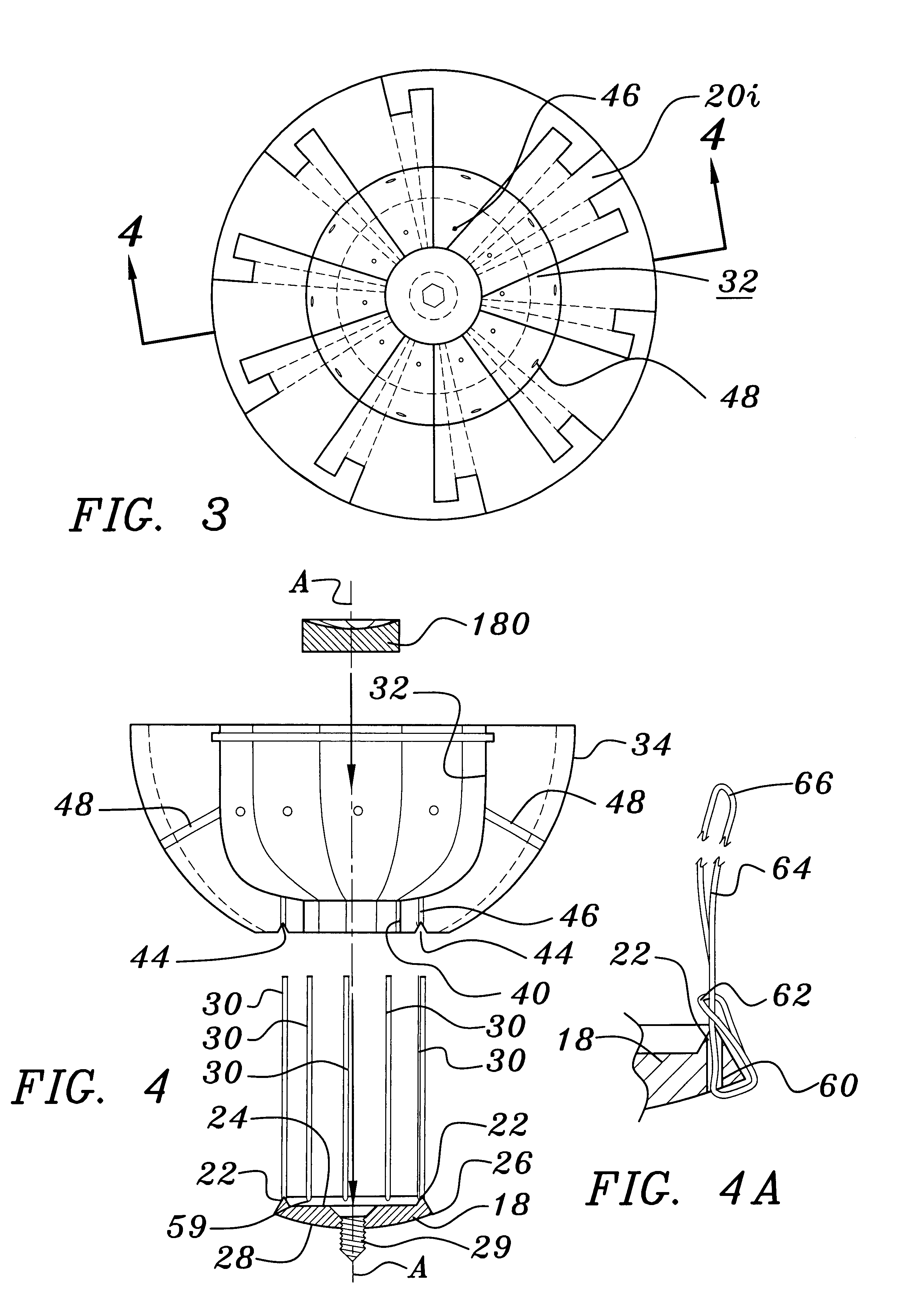 Joint prosthesis and method for placement