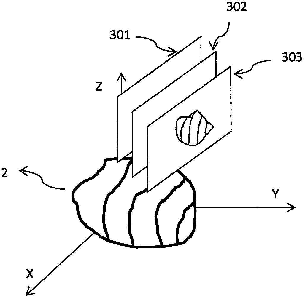 Method for tracking movement of target in body by adopting magnetic resonance imaging