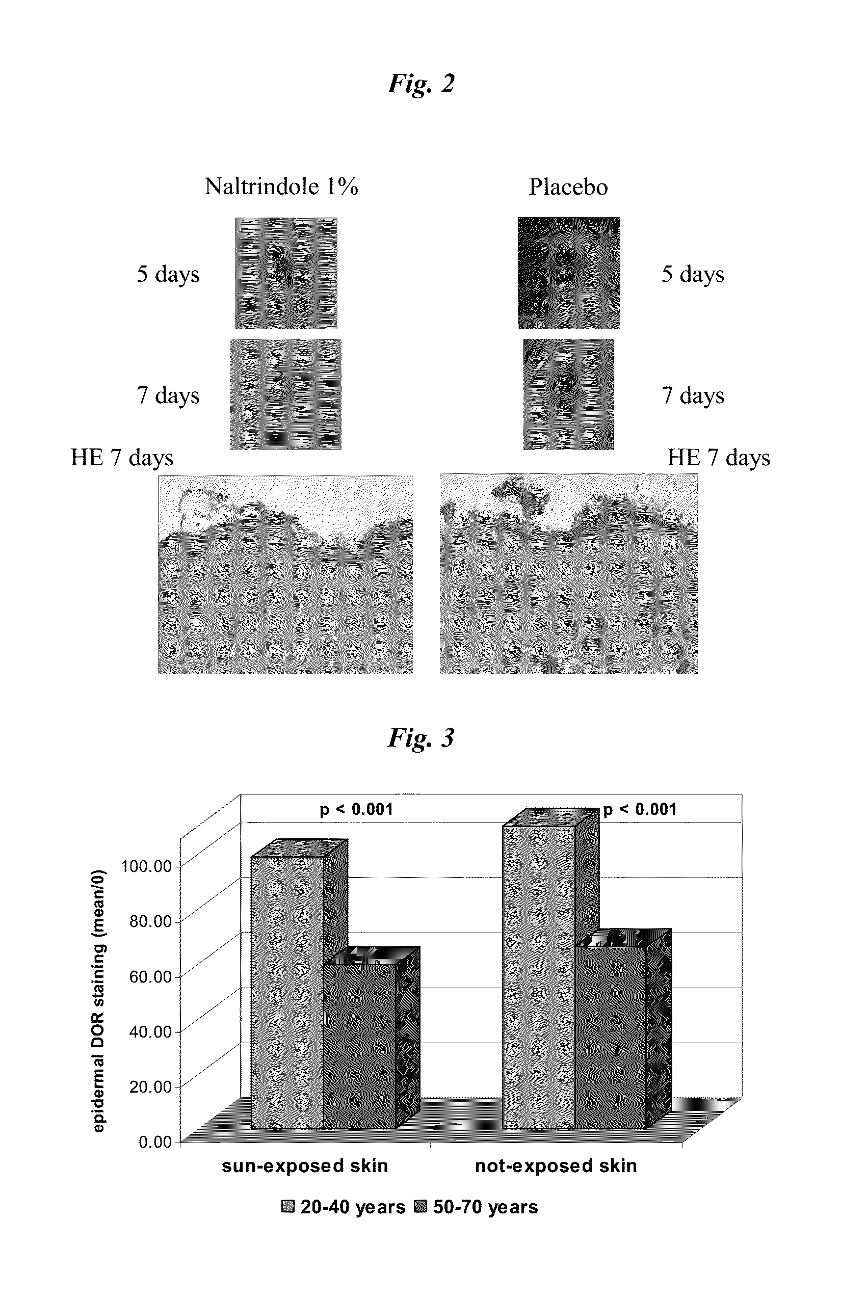 Use of selective delta-opioid receptor antagonists and specific sensory receptor ligands