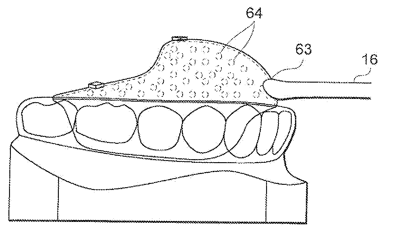 Tongue position controller