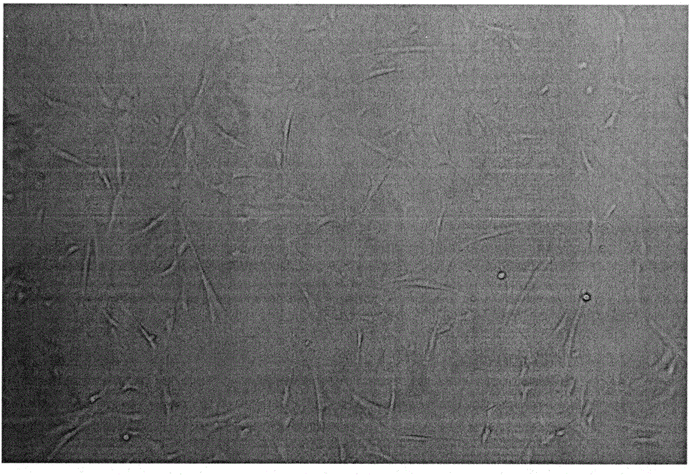 Method of inducing and differentiating human umbilical cord derived mesenchymal stem cells into cartilage cells