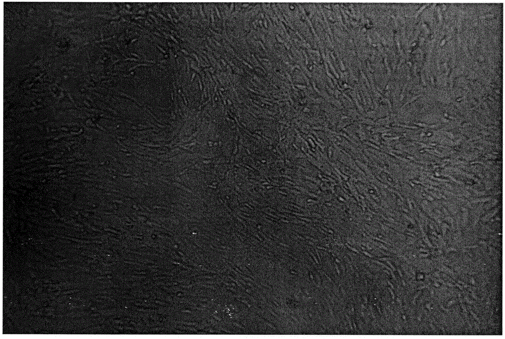 Method of inducing and differentiating human umbilical cord derived mesenchymal stem cells into cartilage cells