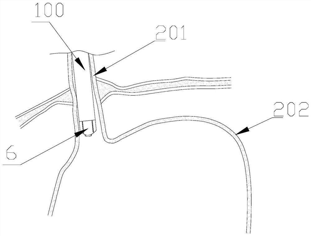 Rigid segment of endoscopic stapler device for performing fundoplication