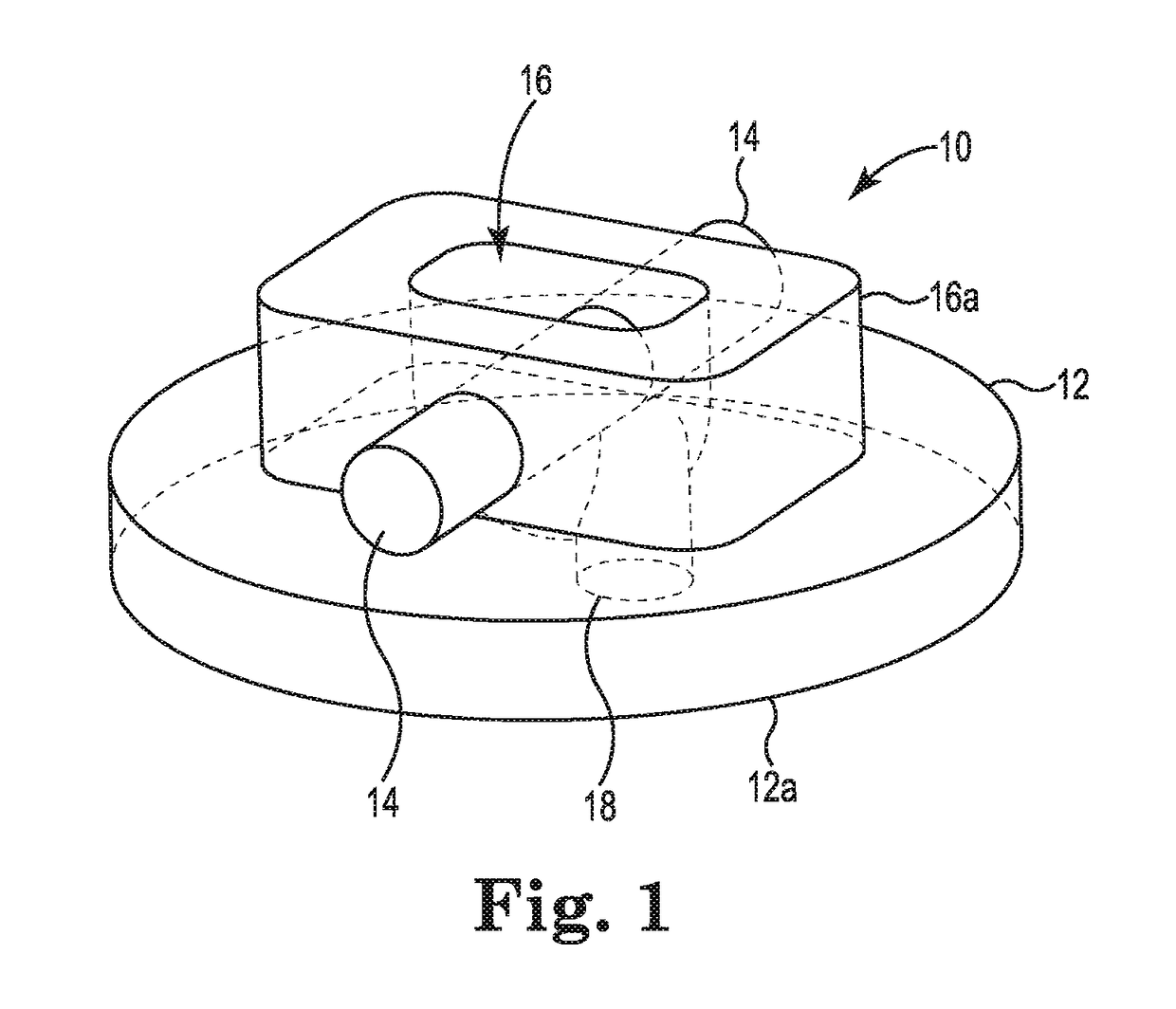 Adjustable suture restriction system and method