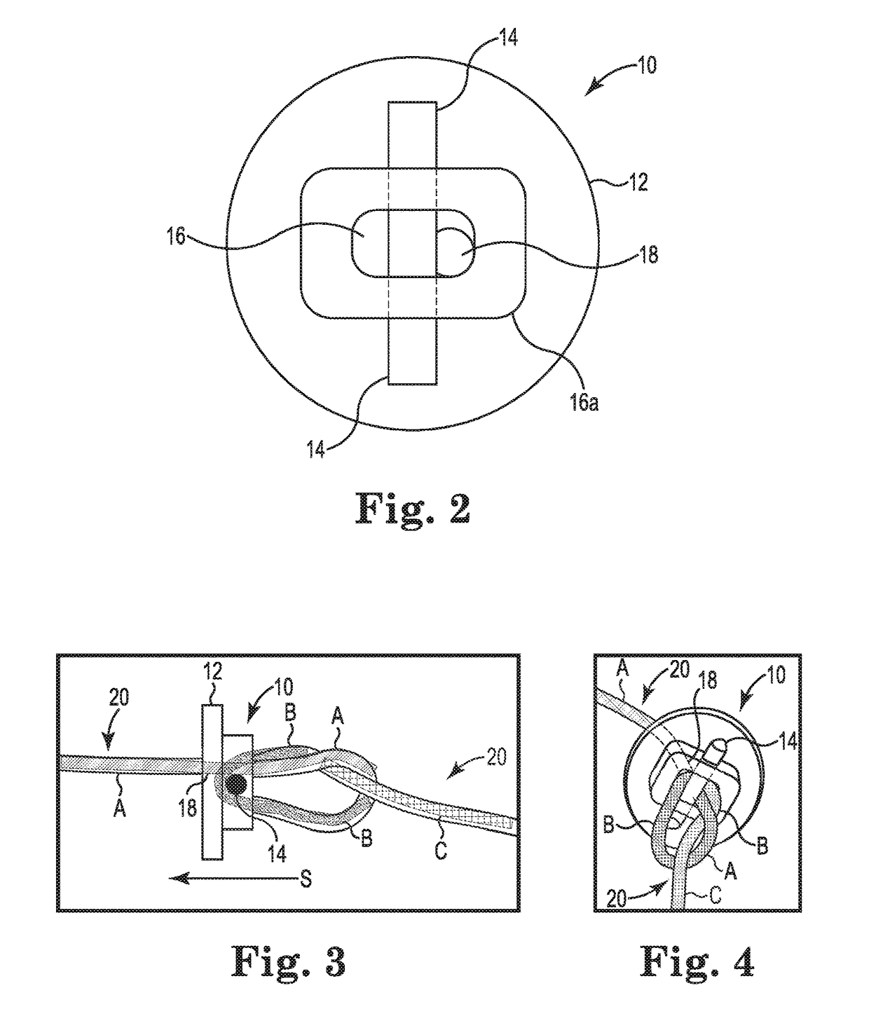 Adjustable suture restriction system and method