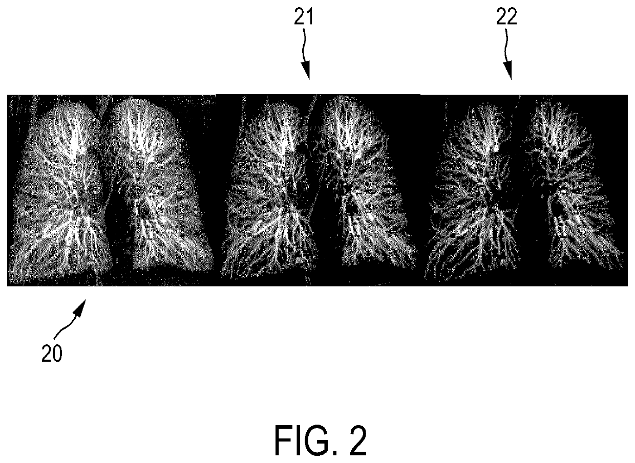 System and method for assessing a pulmonary image