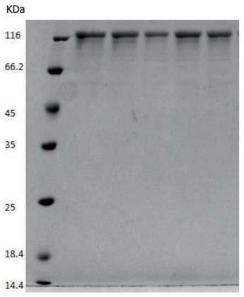 Recombinant human source collagen type-III alpha 1 chain and application thereof