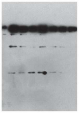 Recombinant human source collagen type-III alpha 1 chain and application thereof