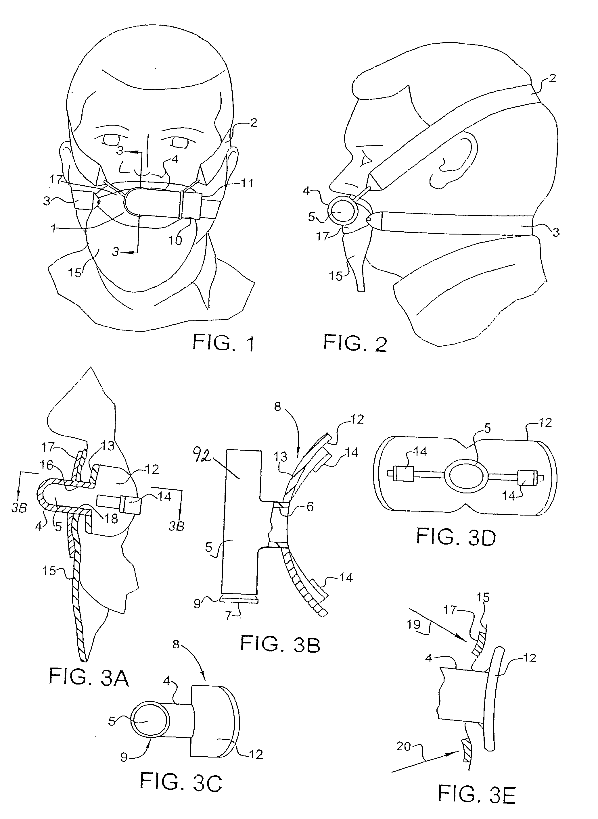 Mouthpiece, nasal seal, head appliance, apparatus, and methods of treating sleep apnea