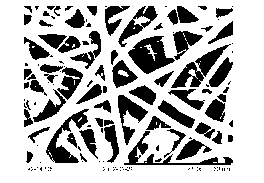 Preparation method of caprolactone lactate copolymer/collagen/chitosan small-caliber intravascular stent