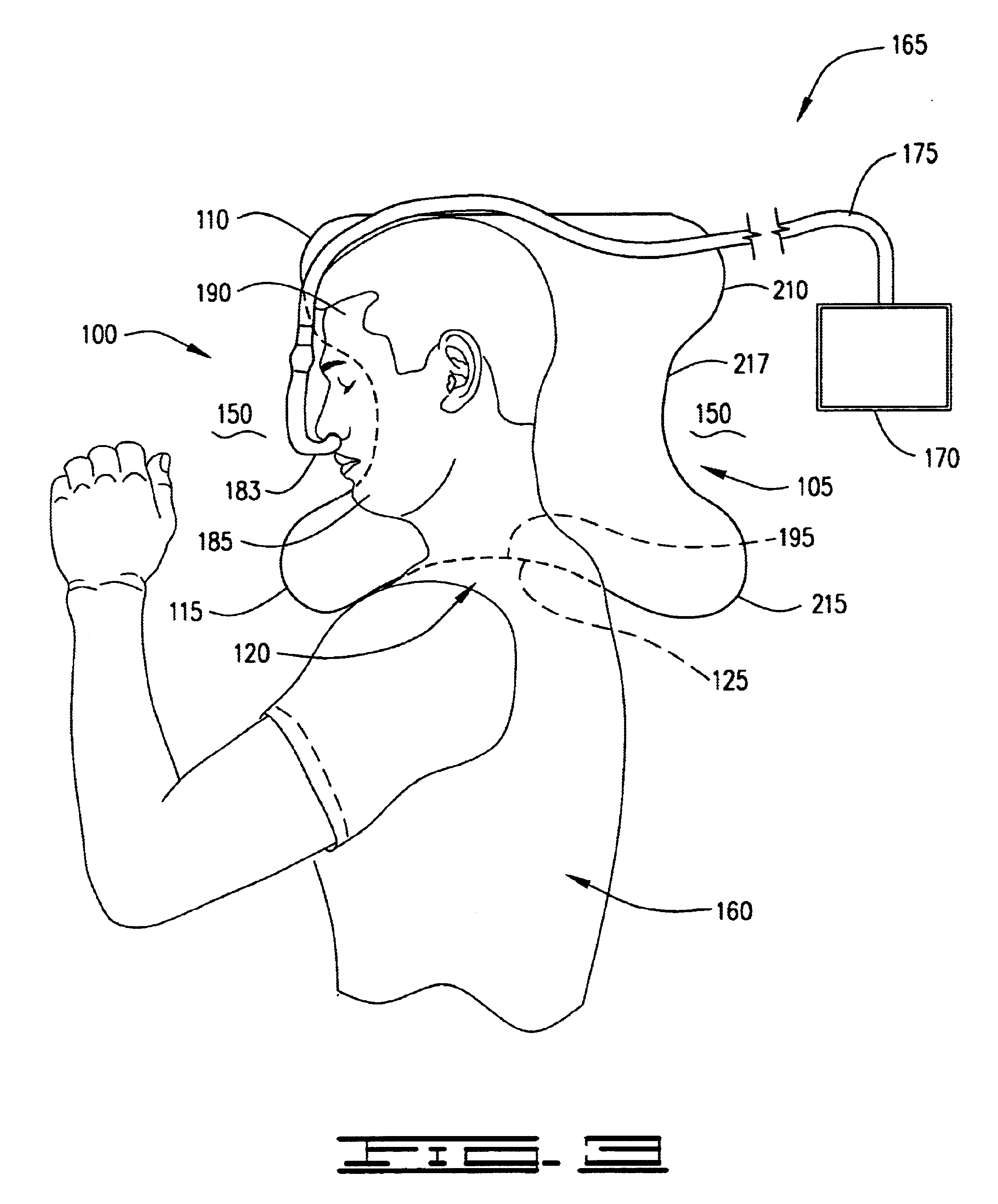 Pressure alleviating pillow