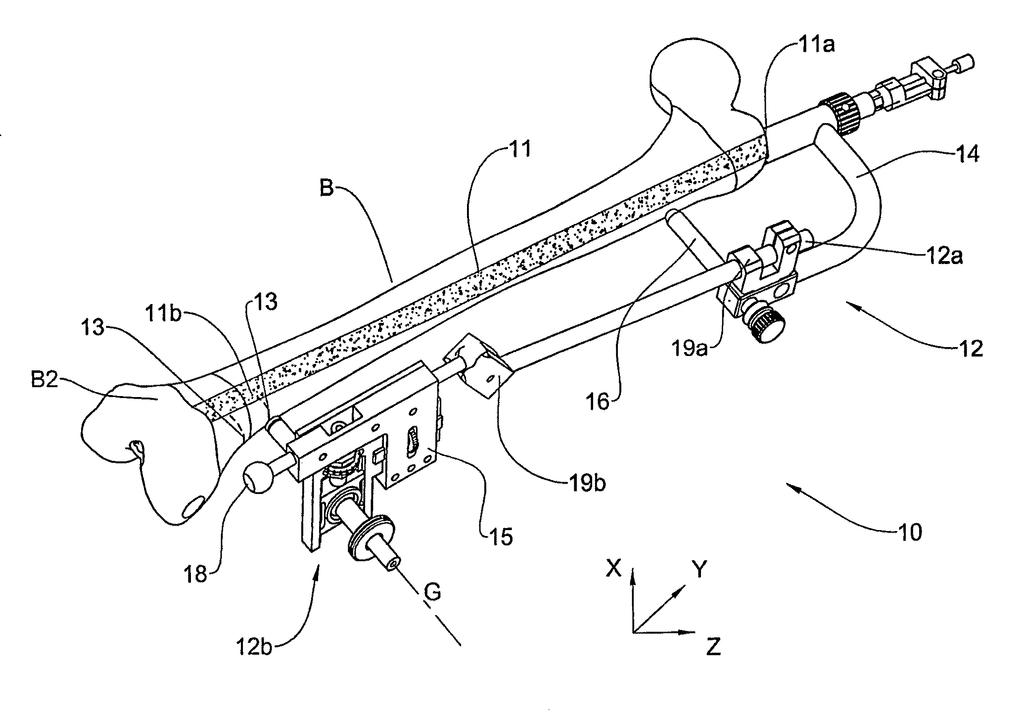 System and method for locating of distal holes of an intramedullary nail