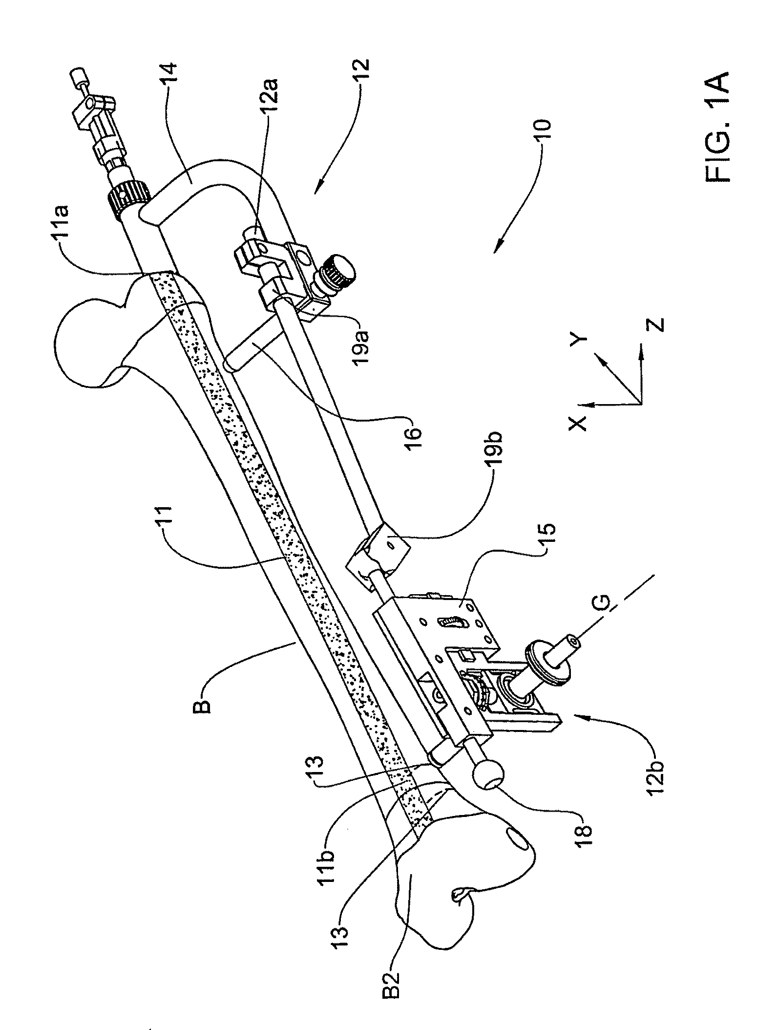 System and method for locating of distal holes of an intramedullary nail