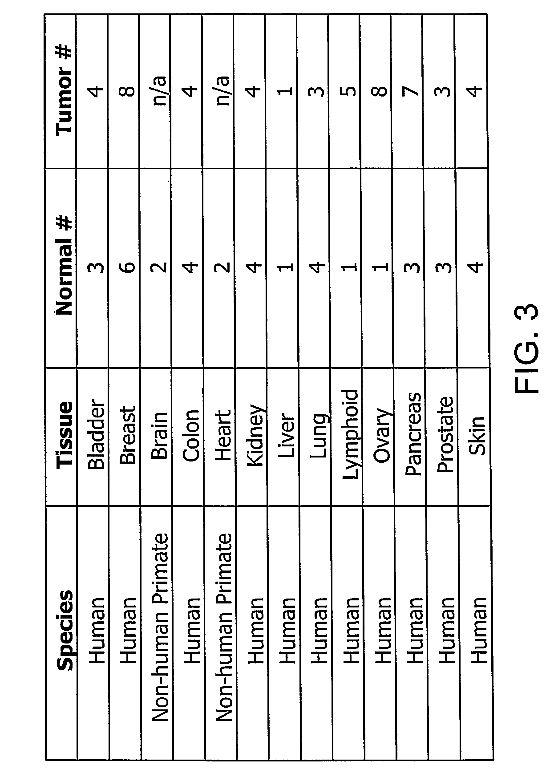 SEMA4D in cancer diagnosis, detection and treatment