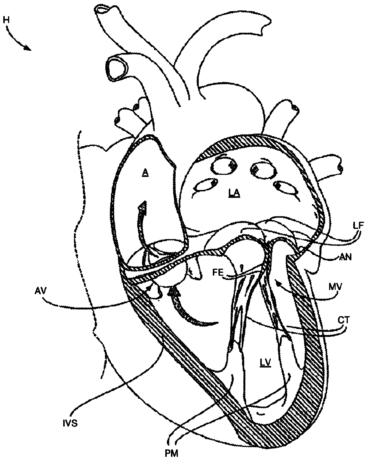 Tissue grasping devices and related methods