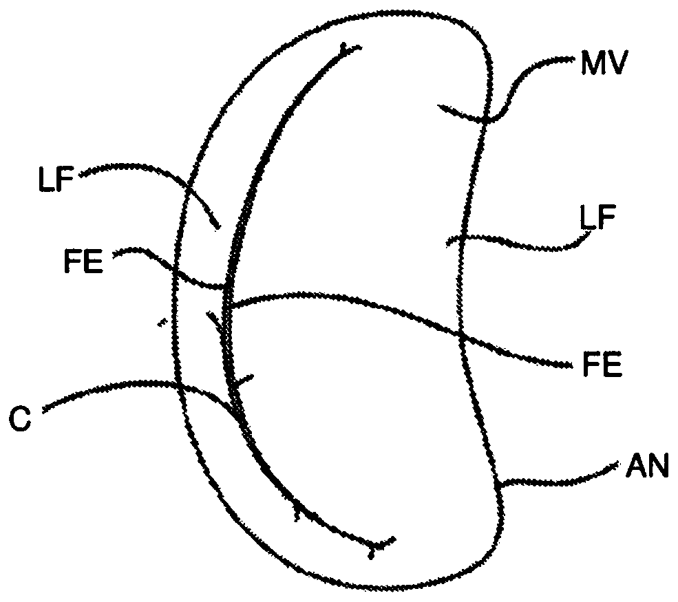 Tissue grasping devices and related methods