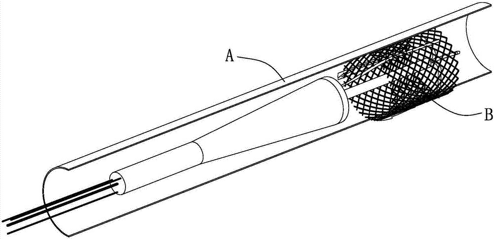 Medical device execution end, interventional treatment system and use method of system