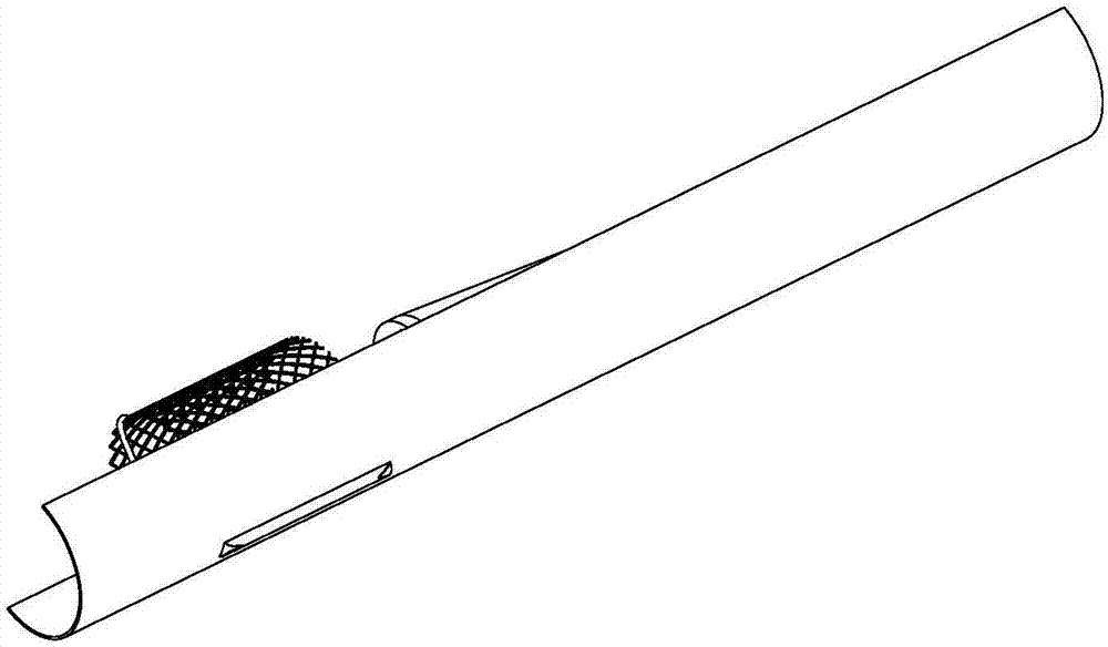 Medical device execution end, interventional treatment system and use method of system