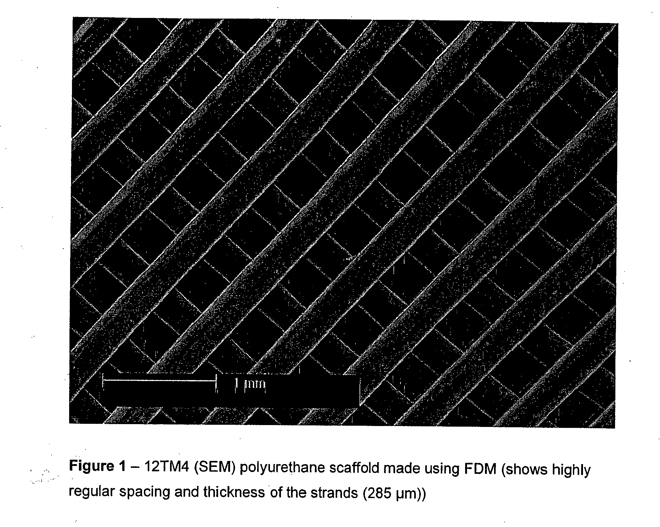 Biodegradable polyurethane and polyurethane ureas