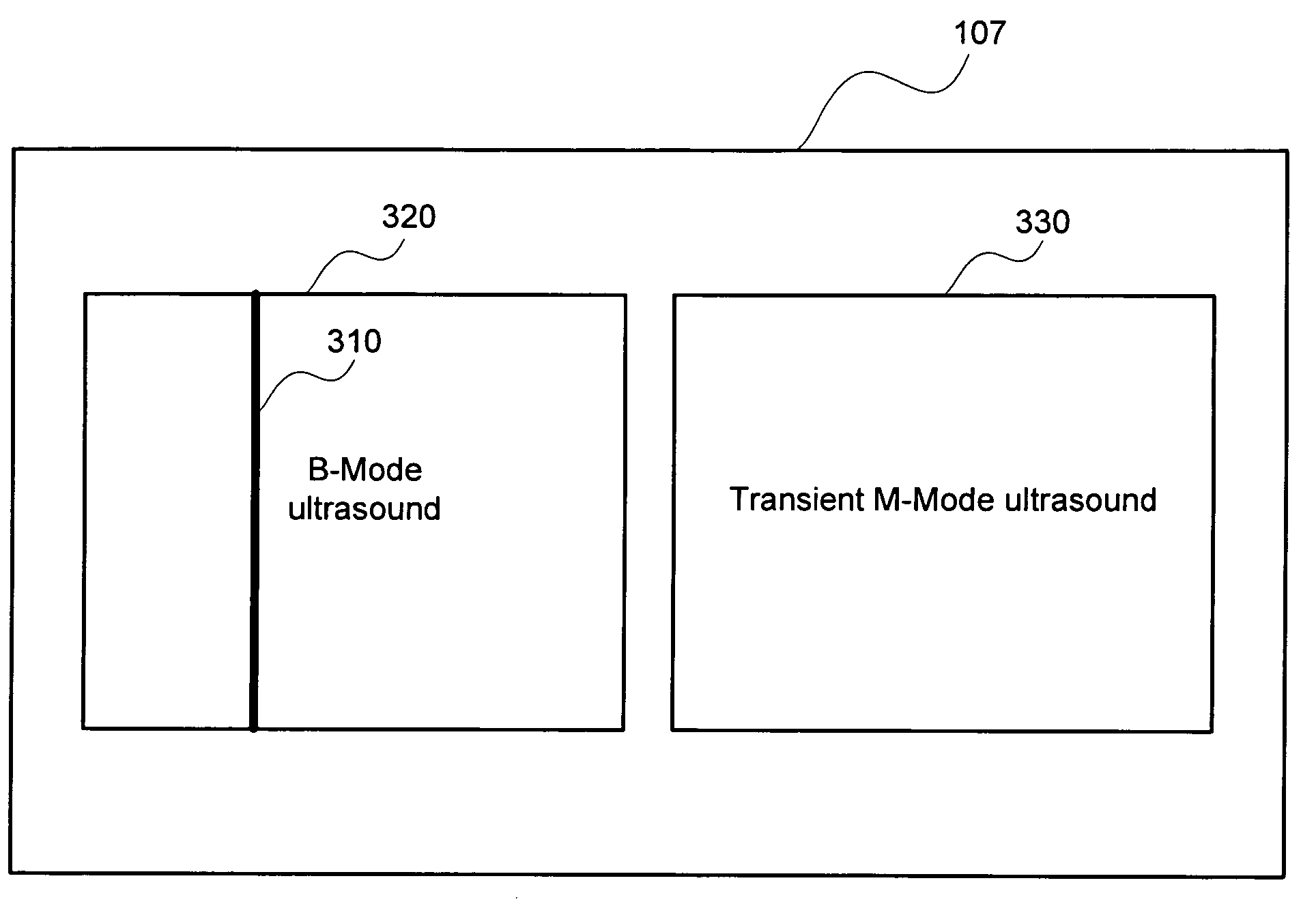 Method and apparatus for ultrasound imaging and elasticity measurement